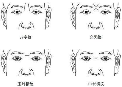 額紋面相